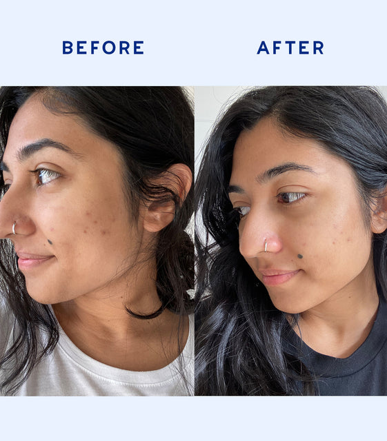 Balance Restoring Serum